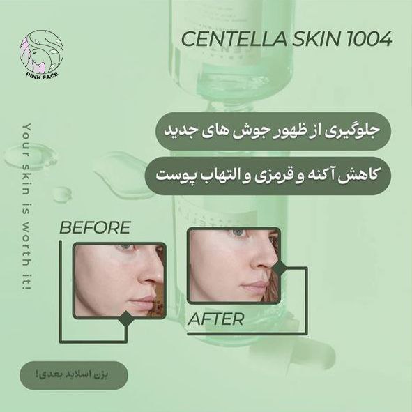 سرم تی تریکا سنتلا 2