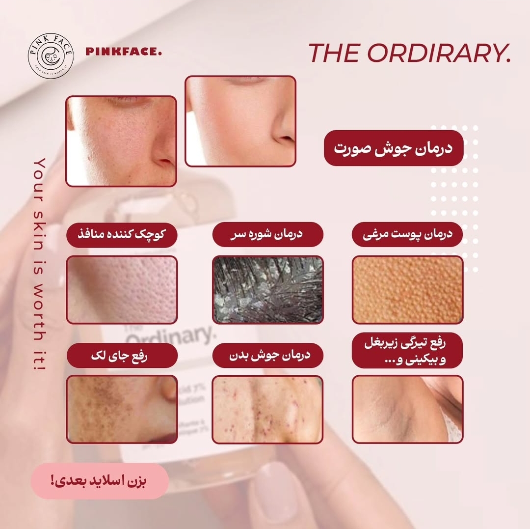 تونر گلیکولیک اسید اوردینری 2