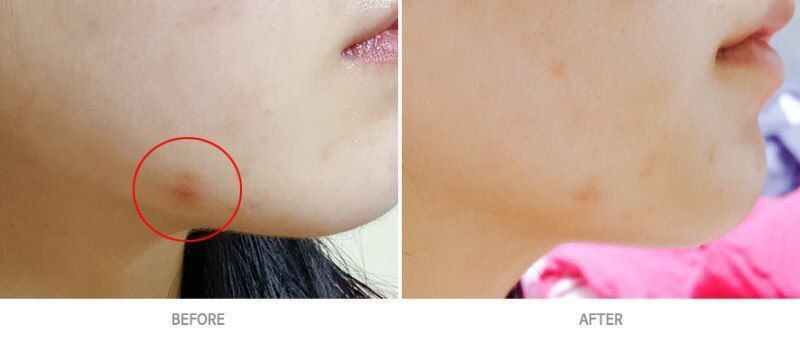 کرم ترمیم کننده قوی سی اس لب 2